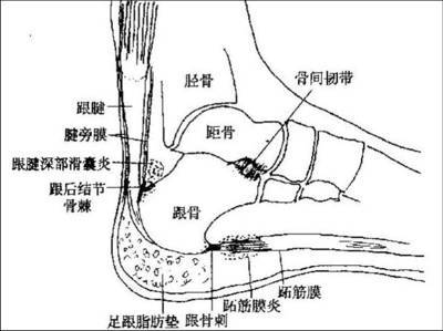 毛织知识 软组织疼痛的相关知识