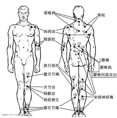 [转载]高清人体穴位图（最全） 人体穴位高清大图下载