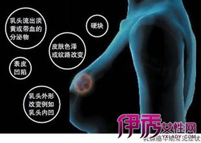 乳房屋硬块但没有疼痛感怎么回事 乳房屋硬块