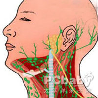 耳后淋巴结肿大怎么回事 耳跟淋巴结肿大怎么办