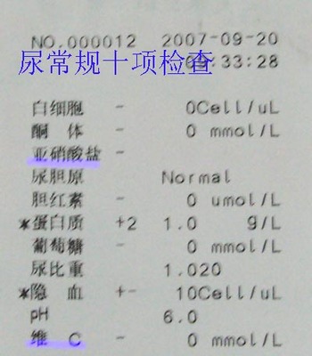 尿常规化验单该怎么看？ 尿常规化验单病理管型