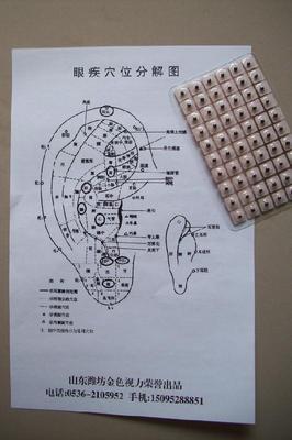 耳穴留置王不留行籽法(附 中医耳穴治疗图) 王不留行籽耳穴贴