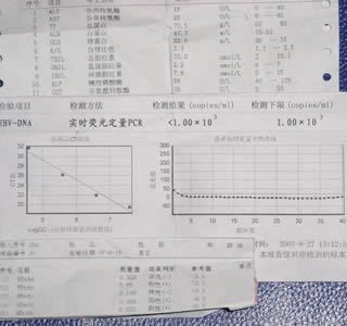 乙肝五项对照表怎么看 乙肝表面抗体阳性