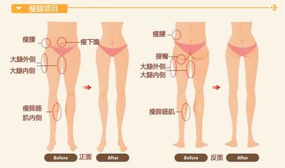 怎么减大腿,怎样减大腿,如何减大腿? 如何减肥瘦大腿