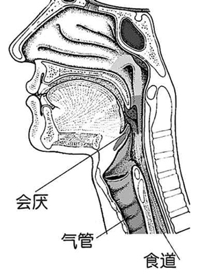 喉咙痛了怎么办 喉咙严重发炎怎么办