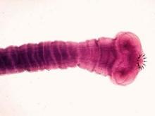 医学常见——人体寄生虫之蛲虫 常见医学词库