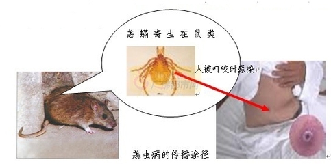 恙虫病预防控制技术指南（试行） 企业风险评估指南试行