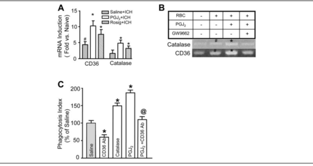 RT-PCR(reversetranscriptasepolymerasechainreaction)逆转录酶- t7 rna polymerase