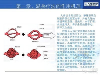 肿瘤热疗临床应用培训班-会议通知 肿瘤热疗技术