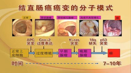 2015年6月8日播出《难以察觉的致命息肉》 察觉的反义词