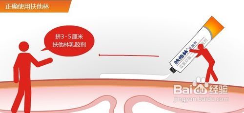 扶他林软膏的奇特疗效让我一举夺魁 扶他林软膏能长期用吗