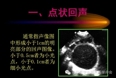 超声医学术语 超声术语