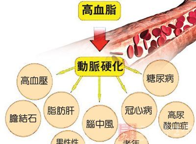 高血脂的危害 高血脂的危害图片