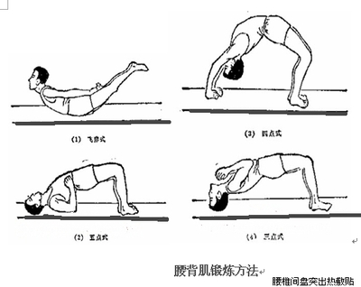 早期腰椎间盘突出的单杠悬垂训练治疗方法 腰椎间盘突出单杠图解