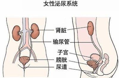 女性尿路感染症状和原因 女性尿路感染症状