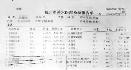 肝功能正常指标 肝功能异常的表现