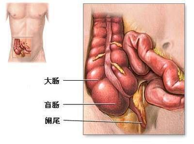 阑尾炎(盲肠炎)治疗偏方15方 阑尾炎与盲肠炎的区别