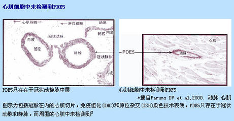 PDE5抑制剂的合理使用 pde5抑制剂多少钱