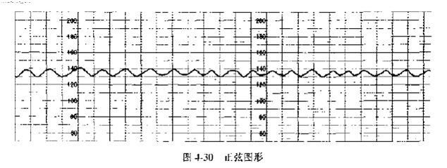 在家也可以做胎心监护 多少周可以做胎心监护