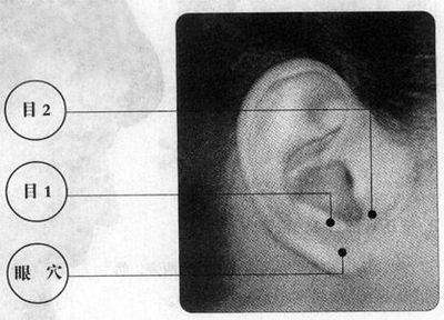 缓解眼睛疲劳的穴位 怎么按摩眼睛缓解疲劳