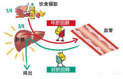 高密度脂蛋白低是怎么回事? 低密度脂蛋白胆固醇