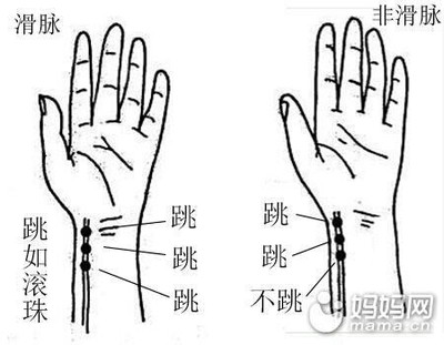 闲情逸趣中医喜脉你也很快就会一抓手腕就知怀孕男女 天涯明月刀ol八荒逸趣