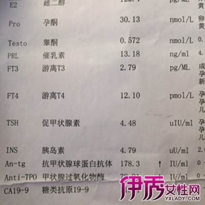 甲状腺过氧化酶抗体偏高会引起什么病 甲状腺微粒体抗体偏高