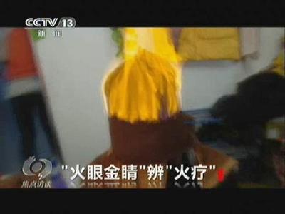 权健火疗基础 权健火疗视频