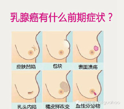 有谁在死亡边界走了一回 乳腺低回声结节边界清