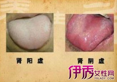 女性肾阳虚和肾阴虚的区别 女性肾既阴虚又阳虚