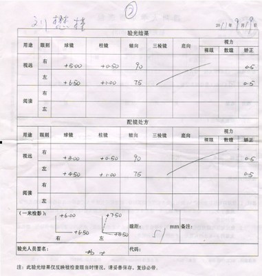 如何看懂视力验光单（转） 视力验光单怎么看