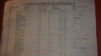 儿子的急性化脓性扁桃体炎 化脓性扁桃体炎