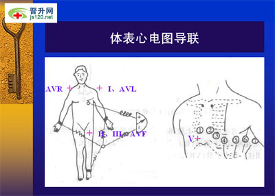 常见异常心电图诊断要点 心电图操作评分标准