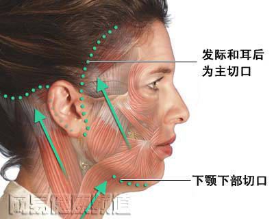 拉皮手术有风险吗 拉皮手术好吗