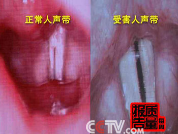 《系统解剖学》90集视频（浙江大学） 系统解剖学柏树令视频