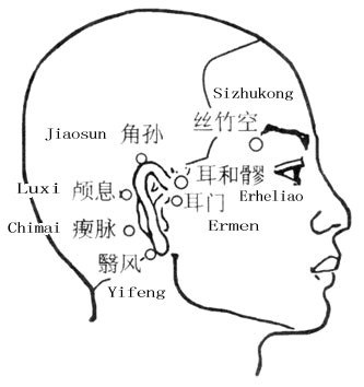 栾加芹：耳朵里的知了不叫了——商阳穴止耳鸣