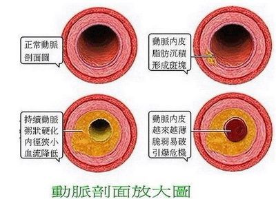 血脂正常范围是多少 ？ 血脂范围