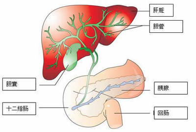 排肝胆结石自然饮食疗法 胆结石自然疗法