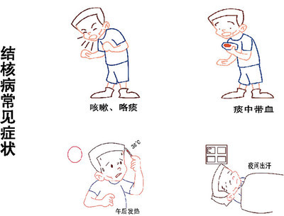 2014.3.24世界防治结核病日宣传报道 结核病防治宣传资料