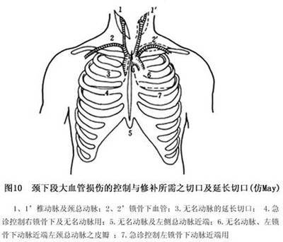 炎症性疼痛 肋间隙回缩原因