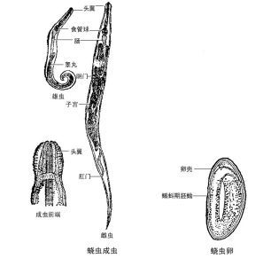 蛲虫病 蛲虫病的最佳治疗方法