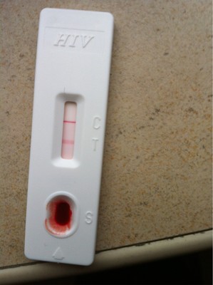 厦门艾滋病HIV检测指南及个人经历 hiv阳性是艾滋病吗