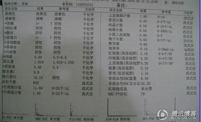 肾功能检查正常值 肾功能不全检查哪些