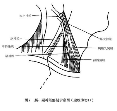 正中神经损伤的神经修复 正中神经损伤康复