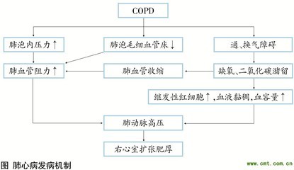 慢性肺源性心脏病 慢性肺源性心脏病病历