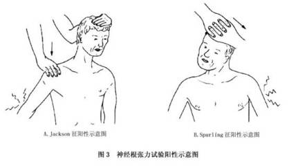 颈椎病的危害有哪些 颈椎病的最好锻炼方法