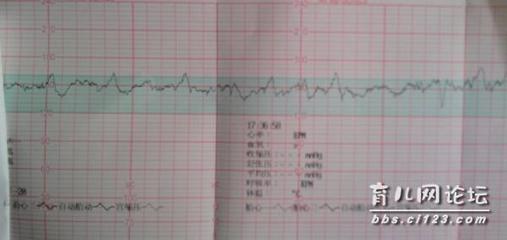 孕晚期妈妈必须知胎心监护解疑 孕晚期胎心快