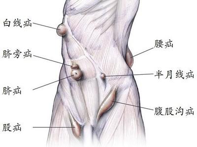 母犬腹股沟疝 腹股沟疝