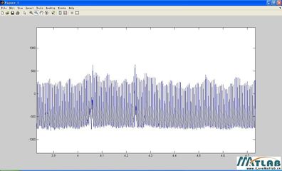 【转】MATLAB中median的用法 matlab median函数