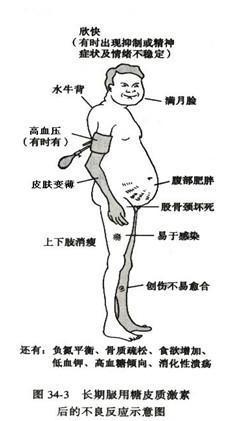 糖皮质激素 糖皮质激素的不良反应